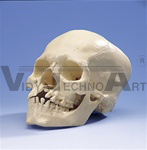 Skull with Cleft Jaw and Plate